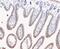 Lysophospholipase 1 antibody, NBP2-80466, Novus Biologicals, Immunohistochemistry paraffin image 