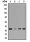 Isocitrate dehydrogenase [NAD] subunit gamma, mitochondrial antibody, orb382523, Biorbyt, Western Blot image 