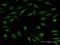 Ubiquitin Like 7 antibody, H00084993-B01P, Novus Biologicals, Immunocytochemistry image 