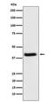 Homeostatic Iron Regulator antibody, M00506, Boster Biological Technology, Western Blot image 