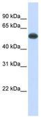 Serine/threonine-protein phosphatase 2B catalytic subunit alpha isoform antibody, TA339198, Origene, Western Blot image 