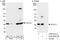 Ubiquitin C-Terminal Hydrolase L3 antibody, A302-948A, Bethyl Labs, Immunoprecipitation image 