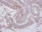 LYN Proto-Oncogene, Src Family Tyrosine Kinase antibody, GTX101222, GeneTex, Immunohistochemistry paraffin image 