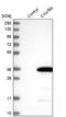 Chromosome X Open Reading Frame 56 antibody, NBP1-82098, Novus Biologicals, Western Blot image 