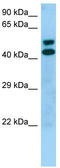 Serine/Threonine Kinase 19 antibody, TA337952, Origene, Western Blot image 