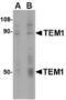 CD248 Molecule antibody, TA306483, Origene, Western Blot image 