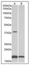 Beta-1,3-Glucuronyltransferase 1 antibody, AP32143PU-N, Origene, Western Blot image 