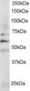 FYN Proto-Oncogene, Src Family Tyrosine Kinase antibody, TA302725, Origene, Western Blot image 