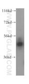 Keratin 16 antibody, 17265-1-AP, Proteintech Group, Western Blot image 