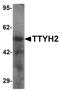 Tweety Family Member 2 antibody, PA5-34395, Invitrogen Antibodies, Western Blot image 