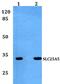 Solute Carrier Family 25 Member 5 antibody, PA5-37120, Invitrogen Antibodies, Western Blot image 
