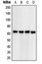 Neuronal PAS Domain Protein 1 antibody, MBS820532, MyBioSource, Western Blot image 