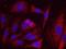 mRNA-decapping enzyme 2 antibody, NBP1-41070, Novus Biologicals, Proximity Ligation Assay image 