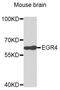 Early growth response protein 4 antibody, abx007379, Abbexa, Western Blot image 