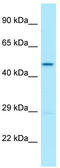 Ubiquinol-Cytochrome C Reductase Core Protein 2 antibody, TA338233, Origene, Western Blot image 