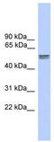 Cerebellar degeneration-related protein 2-like antibody, TA343744, Origene, Western Blot image 