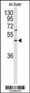 GP160 antibody, 63-979, ProSci, Western Blot image 