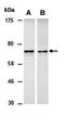 Differentially expressed in FDCP 6 antibody, orb67083, Biorbyt, Western Blot image 