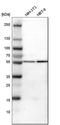 ATPase H+ Transporting V1 Subunit B2 antibody, HPA008147, Atlas Antibodies, Western Blot image 