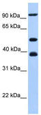 Minichromosome Maintenance Complex Component 3 antibody, TA341682, Origene, Western Blot image 