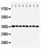 Peptidyl-prolyl cis-trans isomerase D antibody, PA1472, Boster Biological Technology, Western Blot image 