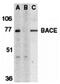 Beta-Secretase 1 antibody, MBS150291, MyBioSource, Western Blot image 