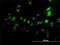 Zinc finger protein 496 antibody, H00084838-M02, Novus Biologicals, Immunocytochemistry image 