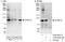 Dual specificity tyrosine-phosphorylation-regulated kinase 1A antibody, A303-801A, Bethyl Labs, Immunoprecipitation image 