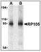 CD180 antigen antibody, AP08924PU-N, Origene, Western Blot image 