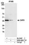 Capping Actin Protein, Gelsolin Like antibody, A305-420A, Bethyl Labs, Immunoprecipitation image 