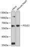 DNA Polymerase Epsilon 2, Accessory Subunit antibody, GTX66125, GeneTex, Western Blot image 