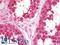 Uncoupling Protein 1 antibody, LS-B10185, Lifespan Biosciences, Immunohistochemistry paraffin image 