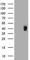 Tubulin Folding Cofactor C antibody, TA504687AM, Origene, Western Blot image 
