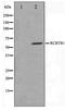 RCC1 And BTB Domain Containing Protein 1 antibody, TA347466, Origene, Western Blot image 