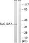 Solute Carrier Family 10 Member 7 antibody, A07374-1, Boster Biological Technology, Western Blot image 