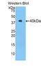 Delta Like Canonical Notch Ligand 4 antibody, LS-C373656, Lifespan Biosciences, Western Blot image 
