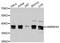 Heterogeneous nuclear ribonucleoprotein A3 antibody, A9669, ABclonal Technology, Western Blot image 