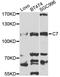 Complement component C7 antibody, A5394, ABclonal Technology, Western Blot image 