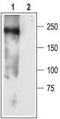 Sodium Voltage-Gated Channel Alpha Subunit 3 antibody, TA329030, Origene, Western Blot image 