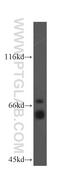 Kinesin Light Chain 1 antibody, 19028-1-AP, Proteintech Group, Western Blot image 