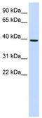 Monoacylglycerol O-Acyltransferase 2 antibody, TA338697, Origene, Western Blot image 