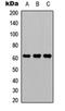 Ataxin-7-like protein 3 antibody, orb234766, Biorbyt, Western Blot image 