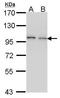 Epidermal Growth Factor Receptor Pathway Substrate 8 antibody, TA307988, Origene, Western Blot image 