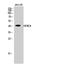 Histone Deacetylase 8 antibody, STJ93485, St John