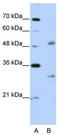 Eukaryotic Translation Initiation Factor 4H antibody, TA343913, Origene, Western Blot image 