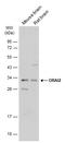 ORAI Calcium Release-Activated Calcium Modulator 2 antibody, GTX120952, GeneTex, Western Blot image 