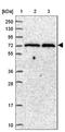 ST18 C2H2C-Type Zinc Finger Transcription Factor antibody, NBP1-92445, Novus Biologicals, Western Blot image 