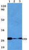 Complement Factor D antibody, PA5-75731, Invitrogen Antibodies, Western Blot image 