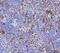 Cell Division Cycle 25B antibody, A01899, Boster Biological Technology, Immunohistochemistry paraffin image 