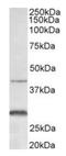 C-X-C Motif Chemokine Receptor 2 antibody, orb12390, Biorbyt, Western Blot image 